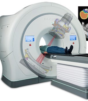 Tomotherapie Tomotherapie